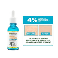 Garnier Anti Acne Serum